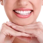 The Ultimate Pre-Wedding Teeth Whitening Plan